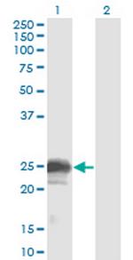 NBL1 Monoclonal Antibody (1G5)