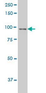 NBN Antibody in Western Blot (WB)