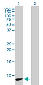 NDUFA3 Antibody in Western Blot (WB)
