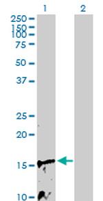 NDUFB3 Polyclonal Antibody, MaxPab™