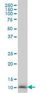 NDUFB3 Monoclonal Antibody (6C6)