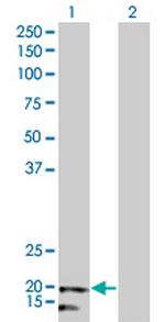 NDUFB5 Monoclonal Antibody (5G5)