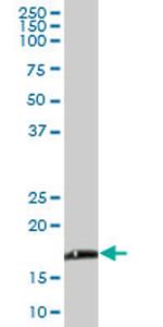 NDUFB6 Antibody in Western Blot (WB)