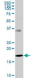 NDUFB7 Polyclonal Antibody, MaxPab™