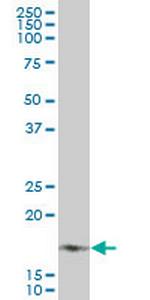 NDUFB7 Monoclonal Antibody (4D4)