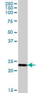 NDUFB10 Antibody in Western Blot (WB)