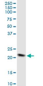 NDUFB10 Antibody in Western Blot (WB)
