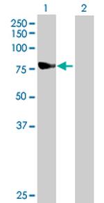 NDUFS1 Polyclonal Antibody, MaxPab™
