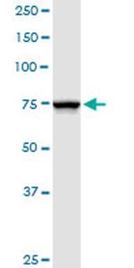 NDUFS1 Antibody in Western Blot (WB)