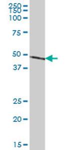 NDUFS2 Antibody in Western Blot (WB)