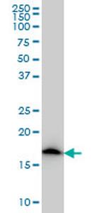 NDUFS4 Antibody in Western Blot (WB)