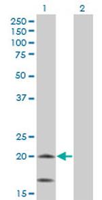 NDUFS4 Antibody in Western Blot (WB)
