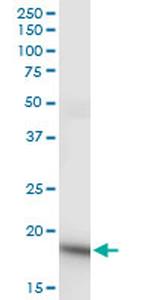 NDUFS4 Monoclonal Antibody (3F11)
