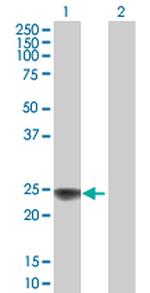 NDUFS8 Polyclonal Antibody, MaxPab™