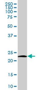 NDUFV2 Antibody in Western Blot (WB)