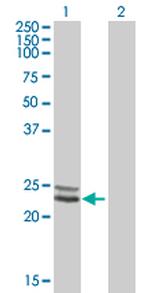 NDUFV2 Polyclonal Antibody, MaxPab™