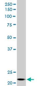 NDUFV2 Antibody in Western Blot (WB)