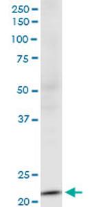 NDUFV2 Antibody in Western Blot (WB)