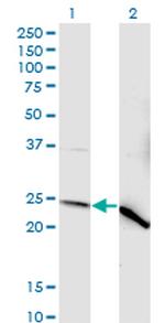 NDUFV2 Monoclonal Antibody (1A10)