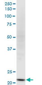 NDUFV2 Antibody in Western Blot (WB)