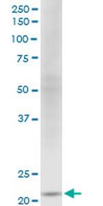 NDUFV2 Antibody in Western Blot (WB)