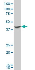 SEPT2 Antibody in Western Blot (WB)