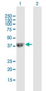SEPT2 Antibody in Western Blot (WB)
