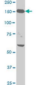 NEFH Monoclonal Antibody (2E8)