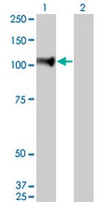 NELL1 Monoclonal Antibody (6A8)