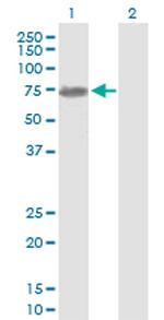 NEFL Antibody in Western Blot (WB)