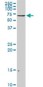 NEFL Antibody in Western Blot (WB)