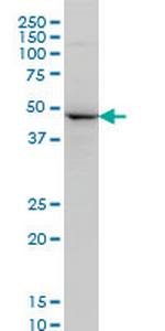 NEK2 Monoclonal Antibody (2F9)