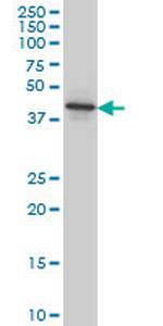 NEU2 Monoclonal Antibody (3B9)