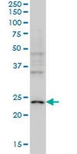 NEUROG1 Monoclonal Antibody (4A2)