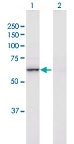 NF2 Polyclonal Antibody, MaxPab™