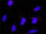 NFKBIB Antibody in Proximity Ligation Assay (PLA) (PLA)