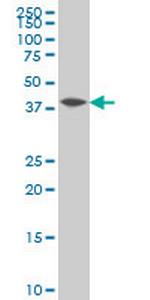 NFKBIB Monoclonal Antibody (2B11)