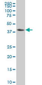 NFKBIB Monoclonal Antibody (3E11)