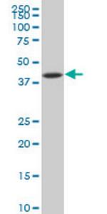 NFKBIB Monoclonal Antibody (3B5)
