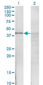 NFKBIB Monoclonal Antibody (1G6)