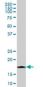 NINJ1 Antibody in Western Blot (WB)