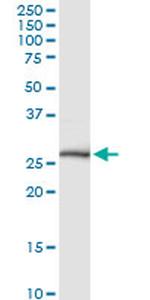 NKX3-1 Monoclonal Antibody (3H6)