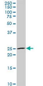 NKX3-1 Monoclonal Antibody (1C7)