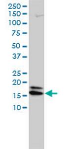 NME2 Monoclonal Antibody (4B7-3F12)