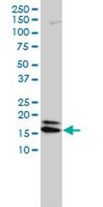 NME2 Antibody in Western Blot (WB)