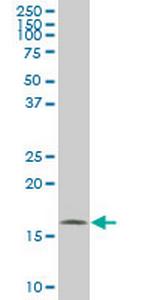 NME2 Monoclonal Antibody (1D4)