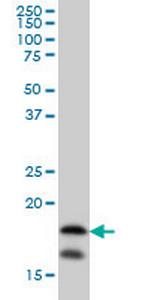 NME2 Monoclonal Antibody (1F2)