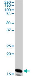NME2 Antibody in Western Blot (WB)