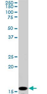 NME2 Antibody in Western Blot (WB)