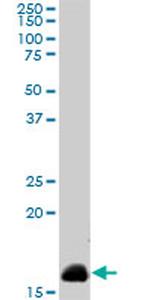 NME2 Antibody in Western Blot (WB)